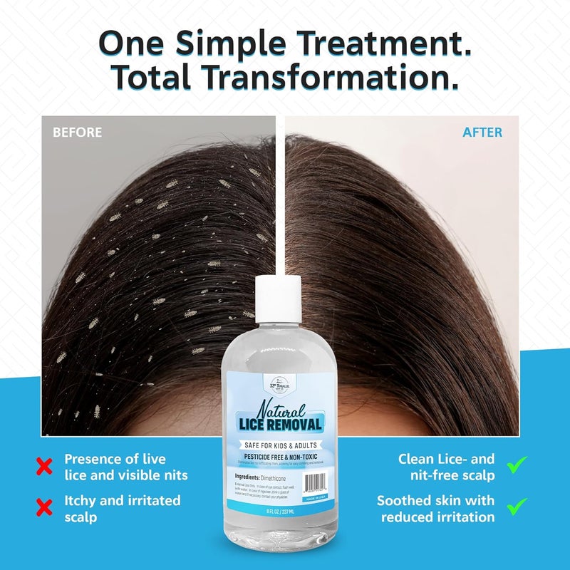 33RD PARALLEL SOAP CO. Safe Natural Lice Treatment for Kids & Adults | Gentle, Non-Irritating Lice Shampoo That Kills Eggs and Lice on All Hair Types | Dimethicone Safely Suffocates | 32oz Treats 3-5 People - Image 3